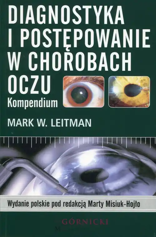 Szybka dostawa Diagnostyka i postępowanie w chorobach oczu