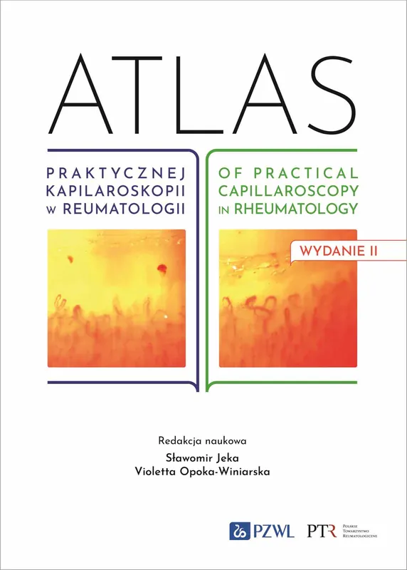 Atlas praktycznej kapilaroskopii w reumatologii. Atlas of practical capillaroscopy in rheumatology Ostatnia szansa